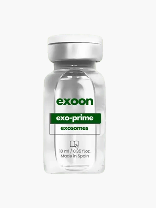 Exoon